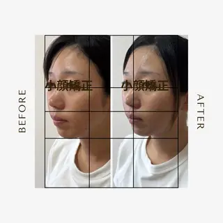 Amaranth所属・Lupinus 小顔矯正のエステ・リラクイメージ