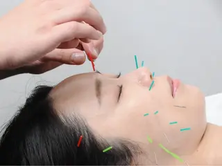 美容鍼・小顔矯正 FLOW 鍼灸整体院のその他イメージ