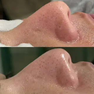 Rairy所属・Rairy Salon富士見町のエステ・リラクイメージ