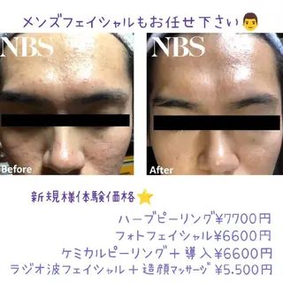 メンズ LaCure～ﾗｷｭｱ～所属・岩田 亜季のエステ・リラクイメージ