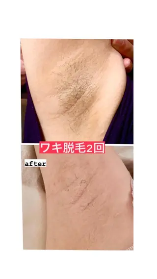 脱毛・エステサロン LuLuNのエステ・リラクイメージ