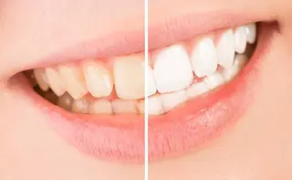 脱毛専門サロンELIXIR（ｴﾘｸｻｰ）所属・脱毛&ホワイトニング ELIXIR×ULTのエステ・リラクイメージ