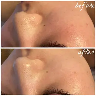 メンズ メナード岐阜市茜部 杉浦のエステ・リラクイメージ