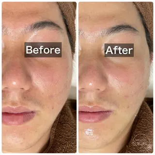 beauty salon  SUKOBI所属・ﾋﾞｭｰﾃｨｻﾛﾝ SUKOBIのエステ・リラクイメージ