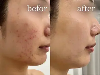 マツエク専門 Angenbelleのマツエク・マツパデザイン