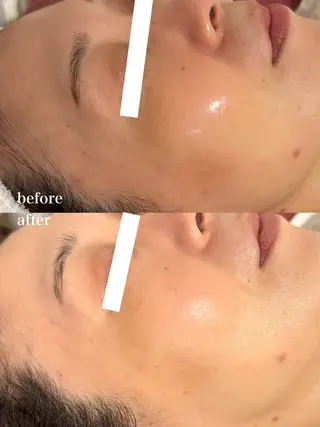 美肌/小顔/眉毛の 専門店 ルミナスのエステ・リラクイメージ