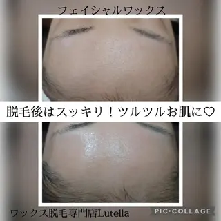 Lutella所属・ワックス脱毛専門店 Lutellaのエステ・リラクイメージ