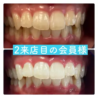 PLATINUM Beauty 横浜店所属・ホワイトニングルーム 横浜店のその他イメージ