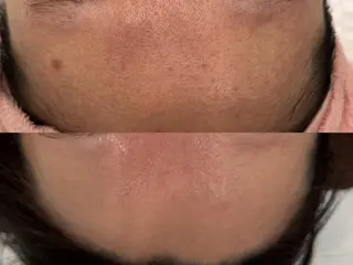 べアール所属・小顔/毛穴/ニキビ salon bealのエステ・リラクイメージ