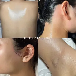 HOTEL&PARK . ワックス脱毛のエステ・リラクイメージ