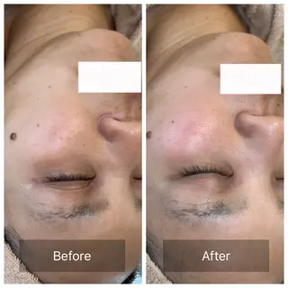 facial aesthetic salon SENTEUR所属・美肌改善/毛穴/シミ サントゥールのエステ・リラクイメージ