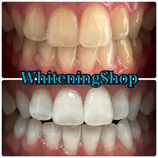 ホワイトニング ショップ吉祥寺店のエステ・リラクイメージ