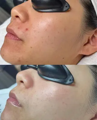 マツエク・マツパ aliaハイフ&水光ジェットサロン所属・aliaハーブ水光店 エステティシャン募集のエステ・リラクイメージ