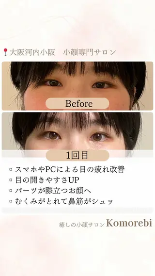 営業電話❌小顔サロン Komorebiのエステ・リラクイメージ