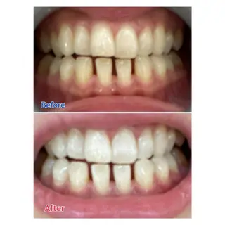 MBEAUTYSALON 千葉店・京成大久保所属・Melty 輝のその他イメージ