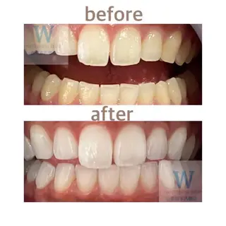 ホワイトニング ショップ本八幡店のエステ・リラクイメージ