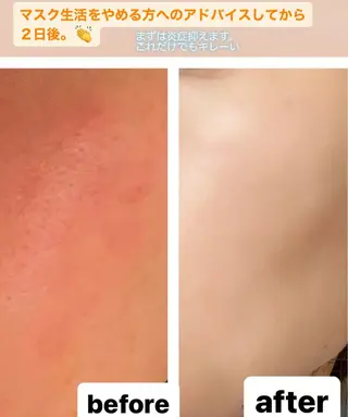 ð
ð
€ð
©ð
ð
salonã®ãšã¹ãã»ãªã©ã¯ã€ã¡ãŒãž