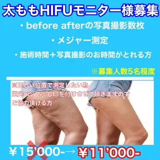 痩身/脱毛/ネイル HARUKAのエステ・リラクイメージ