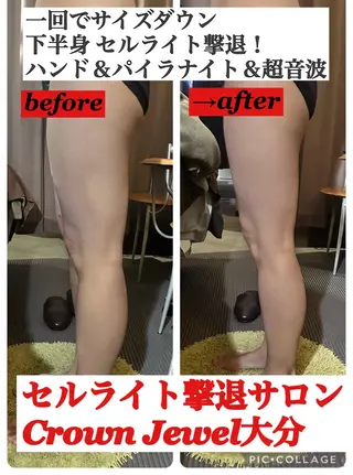 Crown  Jewel所属・CrownJewel クラウン ジュエルのエステ・リラクイメージ