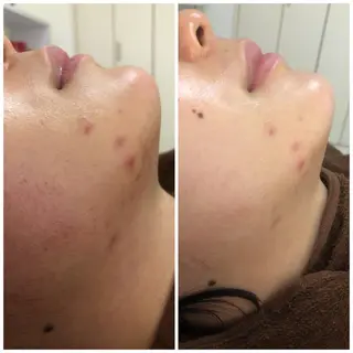 ロング カラー パーマ ヘアアレンジ メンズ キッズ ネイル マツエク・マツパ Amaryllis 🌹のエステ・リラクイメージ