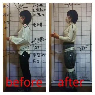 お顔のむくみたるみ 専門☆美容鍼小顔矯正のエステ・リラクイメージ