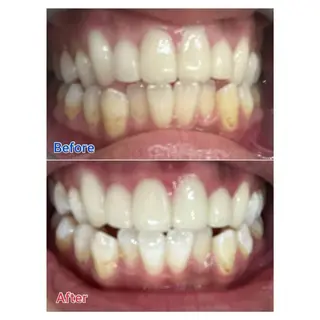 MBEAUTYSALON 千葉店・京成大久保所属・Melty 輝のその他イメージ