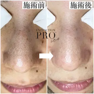 隅田 都布子のマツエク・マツパデザイン