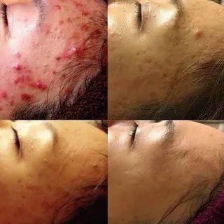 LiZA エステティックサロンのエステ・リラクイメージ