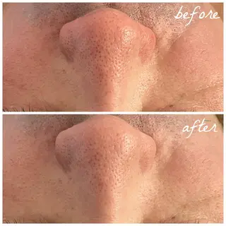 メンズ メナード岐阜茜部 杉浦のエステ・リラクイメージ