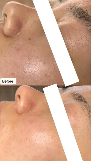 マツエク・マツパ aliaハイフ&水光ジェットサロン所属・aliaハーブ水光店 エステティシャン募集のエステ・リラクイメージ