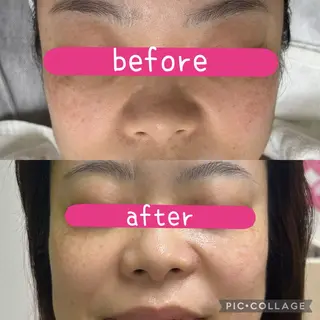 DeI'm柴田所属・【肌質改善サロン】 Harunaのネイルデザイン