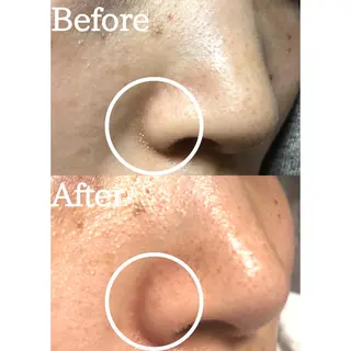 BestBelleꕤ 大阪福島/肌質改善のエステ・リラクイメージ