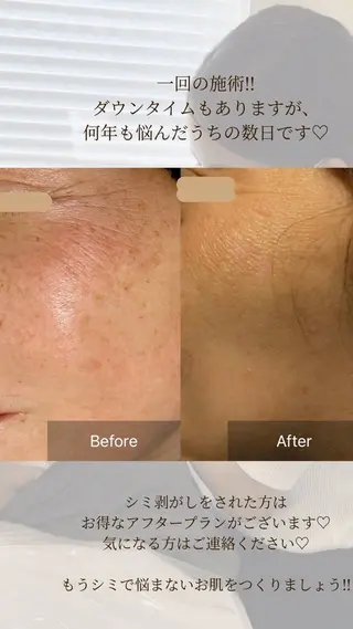 毛穴が見えなくなるサロン  Horo所属・岡 えり子のエステ・リラクイメージ