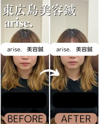 arise.所属・東広島美容鍼 /arise.のその他イメージ