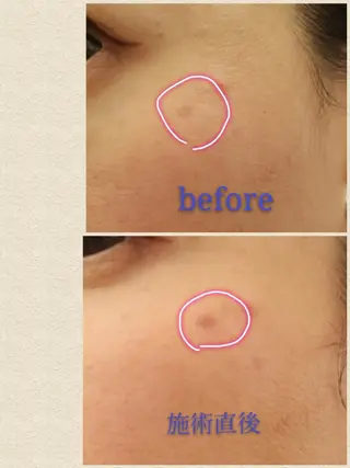 🅖🅤🅩🅔🅛 salonのエステ・リラクイメージ