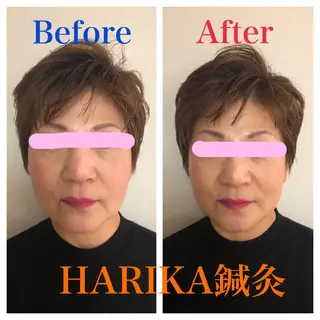 HARIKA鍼灸所属・HARIKA 鍼灸のその他イメージ