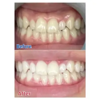 M渋谷店所属・M渋谷 ホワイトニングのエステ・リラクイメージ