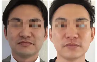 メンズ Bemott 日進のエステ・リラクイメージ