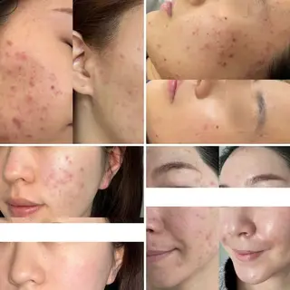 マツエク・マツパ 愛維美水光美肌専門店所属・愛維美水光美肌専門店 メンズレディースokのエステ・リラクイメージ