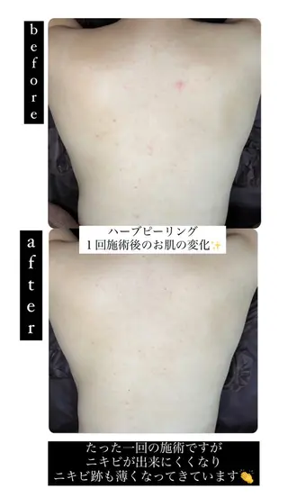 ベラージュ【美背中・ 美尻・フェイシャル】のエステ・リラクイメージ