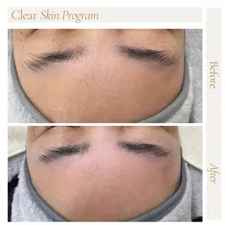 BLOOMi.(CARRIE NAIL内)所属・肌悩み専門店 BLOOMi.のエステ・リラクイメージ