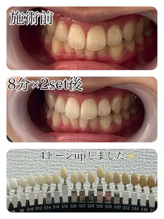 セルフホワイトニング 池袋　プラネットのその他イメージ