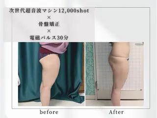 小顔矯正専門店 【RED】池田のエステ・リラクイメージ