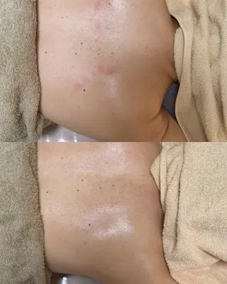 肌質改善専門サロンAte国分寺店所属・Ate Rikaのエステ・リラクイメージ