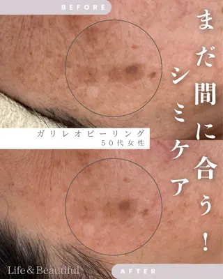 Life＆ Beautifulのエステ・リラクイメージ