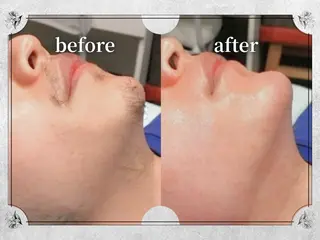 Lino by MIRA/Yuinaのエステ・リラクイメージ