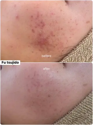 メンズ キッズ ネイル Fu 辻堂店のネイルデザイン