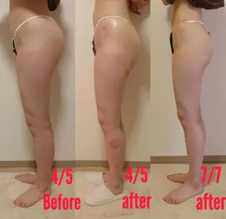 a  room salonのエステ・リラクイメージ