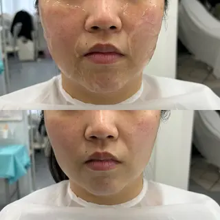 よもぎ蒸し×肌育【aju】所属・おかま直伝よもぎ蒸し 【aju】山本 亜樹のエステ・リラクイメージ