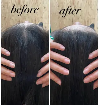 ate'所属・個室ドライヘッドスパ 🍃moriのエステ・リラクイメージ